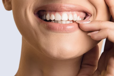 Gummy Smile Behandlung Berlin