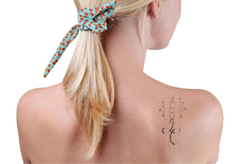 Cover-Up Aufhellung mit Picosure in Berlin