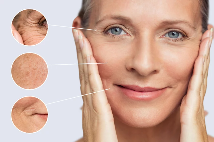 HIFU Lifting in Berlin