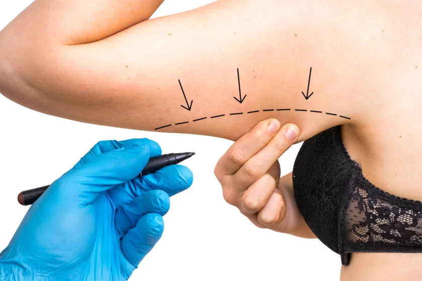 Oberarme straffen in Berlin