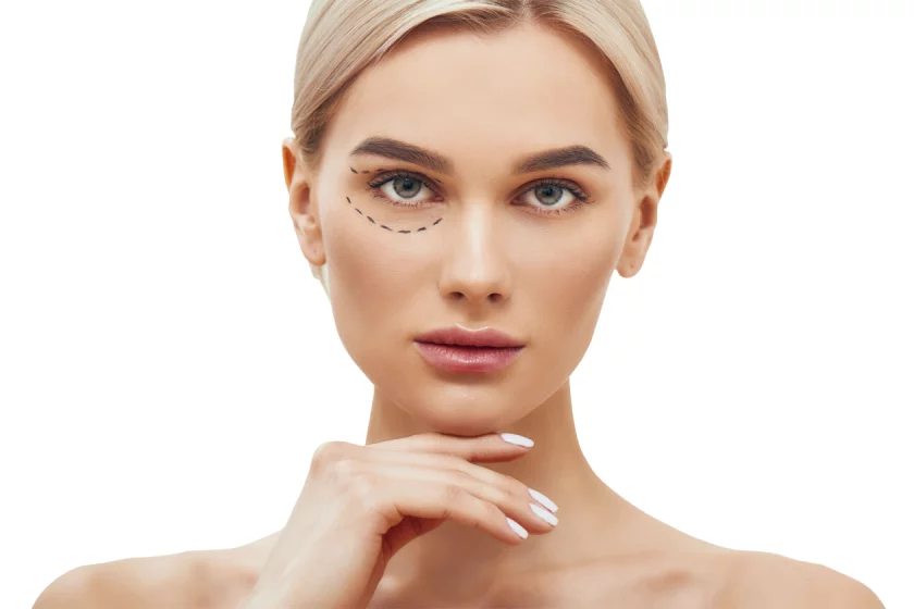 Tränensäcke entfernen in Berlin